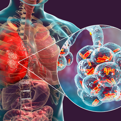 respiratory-tract-infection