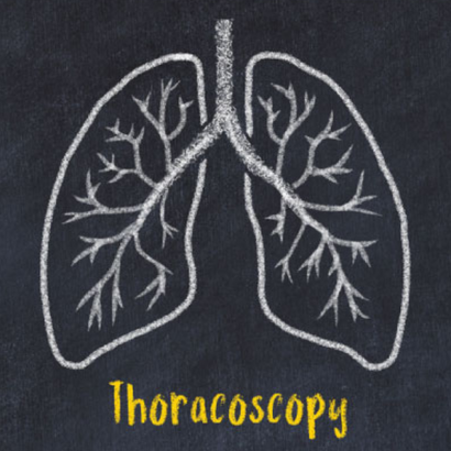 thoracoscopy-Kondapur